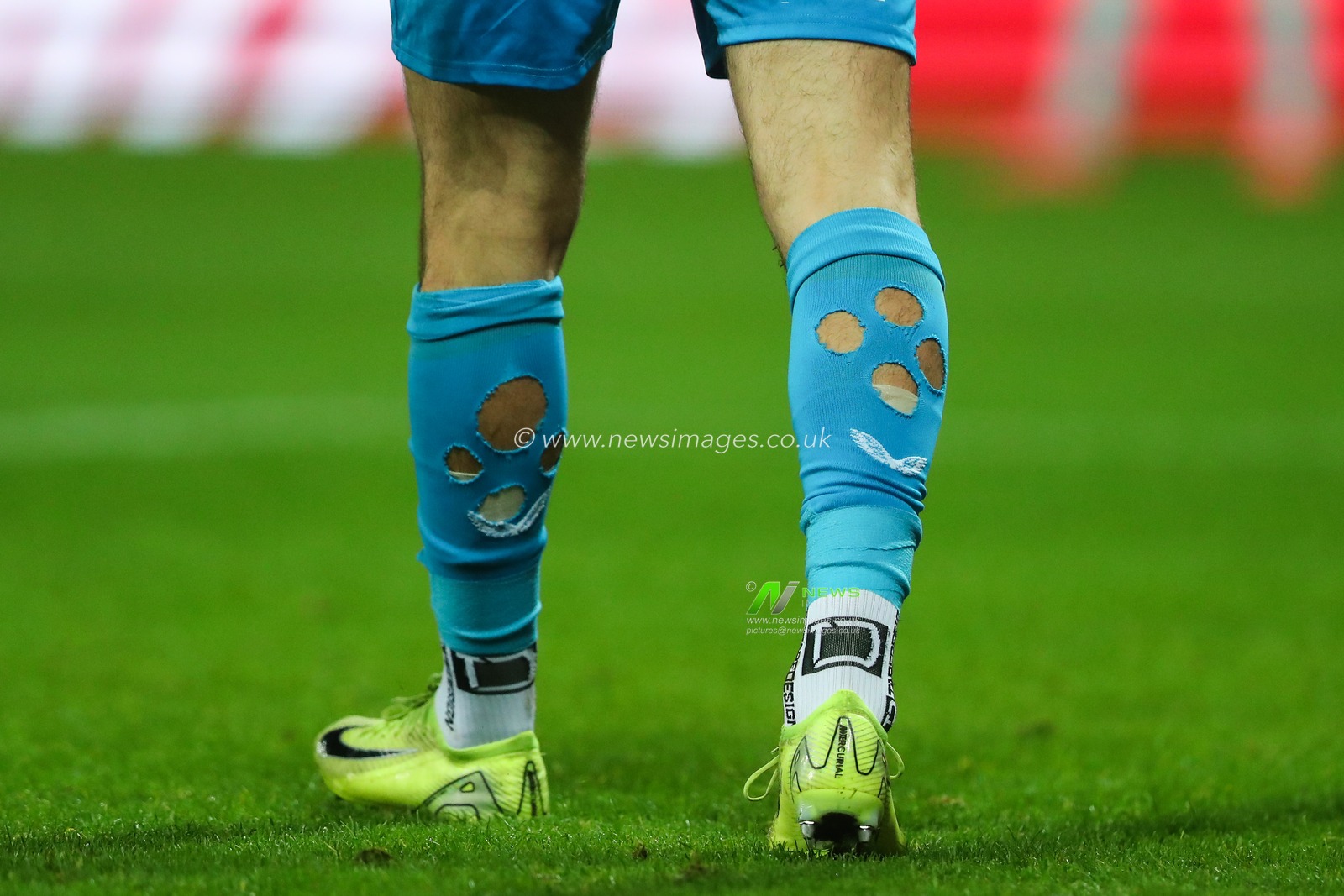 The cut socks of James Trafford of Burnley during the Sky Bet Championship match West Bromwich Albion vs Burnley at The Hawthorns, West Bromwich, United Kingdom, 7th November 2024

(Photo by Gareth Evans/News Images)
