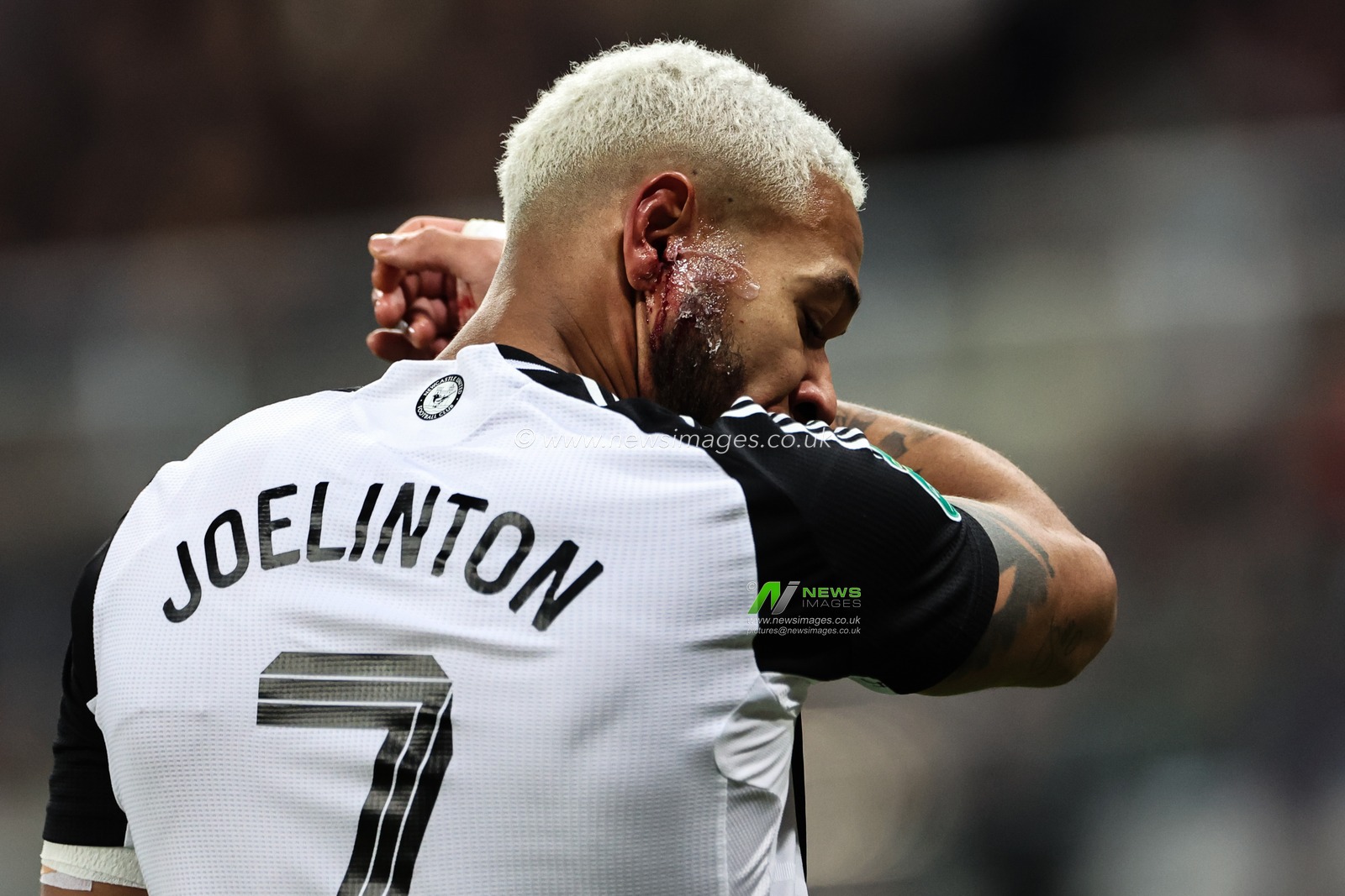 Joelinton of Newcastle United with a cut to the ear during the Carabao Cup Quarter Final Newcastle United vs Brentford at St. James's Park, Newcastle, United Kingdom, 18th December 2024

(Photo by Mark Cosgrove/News Images)
