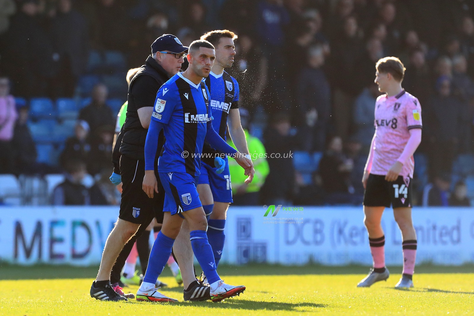 Stuart O'Keefe #4 of Gillingham with a cut face.