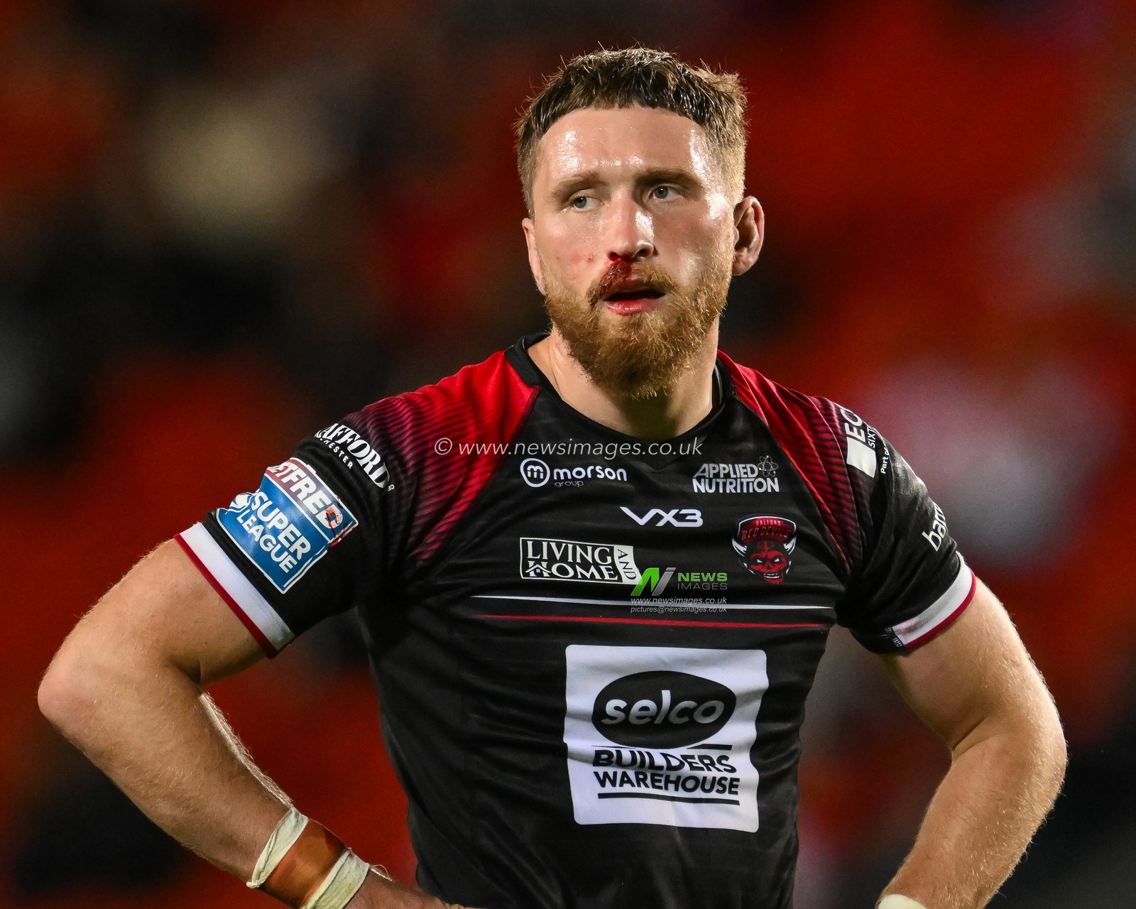 Ethan Ryan of Salford Red Devils with a bloody nose during the Betfred Super League Round 21 match St Helens vs Salford Red Devils at Totally Wicked Stadium, St Helens, United Kingdom, 8th August 2024

(Photo by Craig Thomas/News Images)