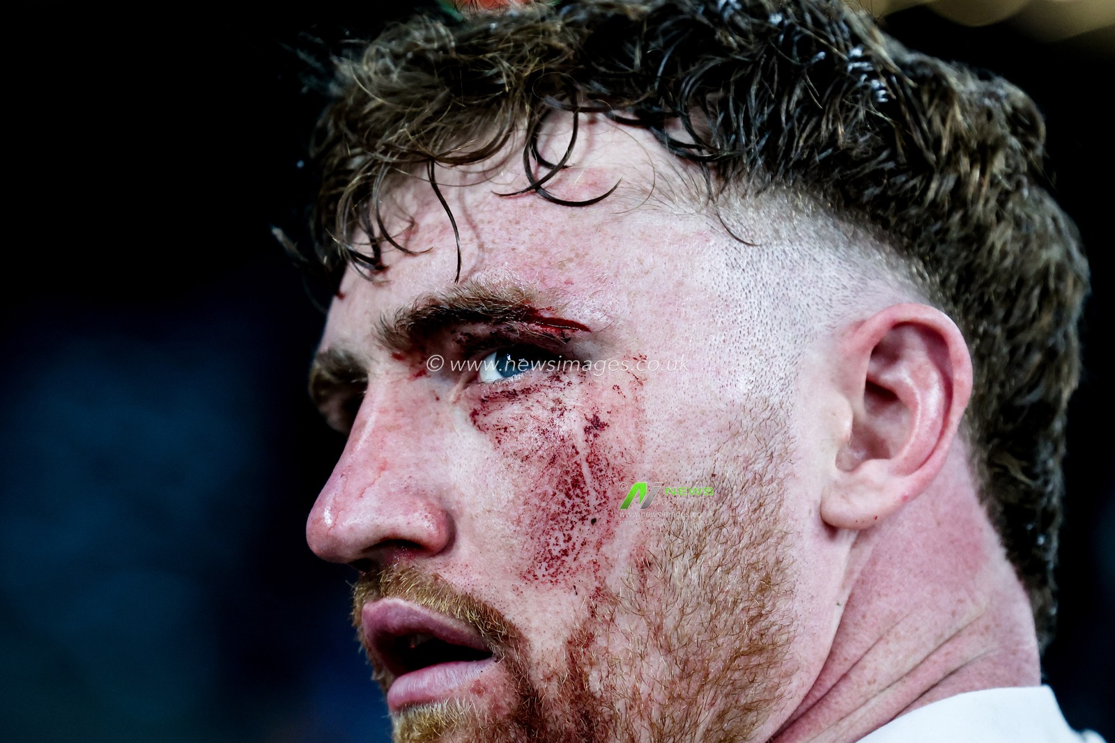 Ollie Chessum of England with a deep laceration  to his left eye during the 2025 Guinness 6 Nations match England vs Scotland at Allianz Stadium, Twickenham, United Kingdom, 22nd February 2025

(Photo by Mark Cosgrove/News Images)
