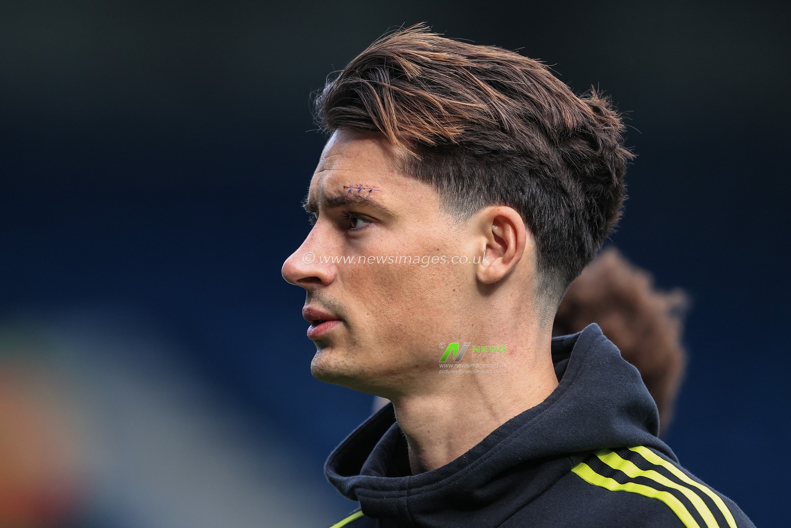 Robin Koch #5 of Leeds United with a scar to his left eye from last weekends game with Manchester United