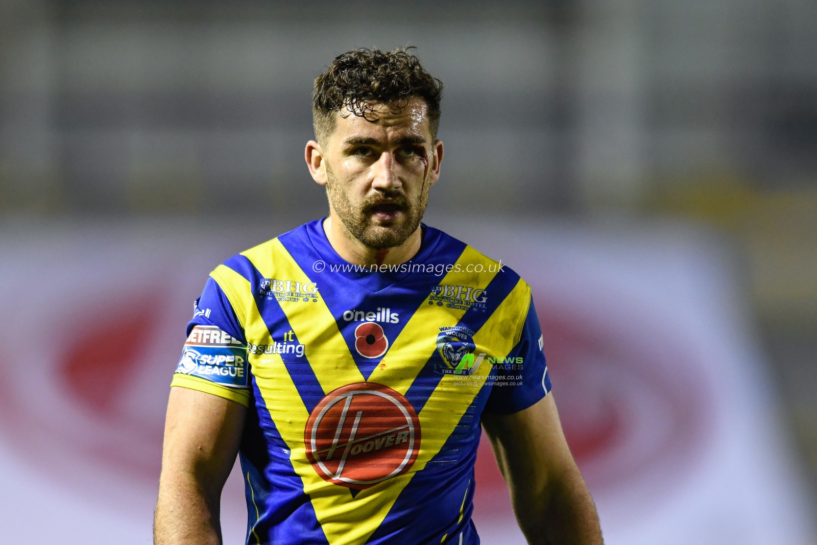 Toby King #4 of Warrington Wolves has blood pouring from a cut above his eye