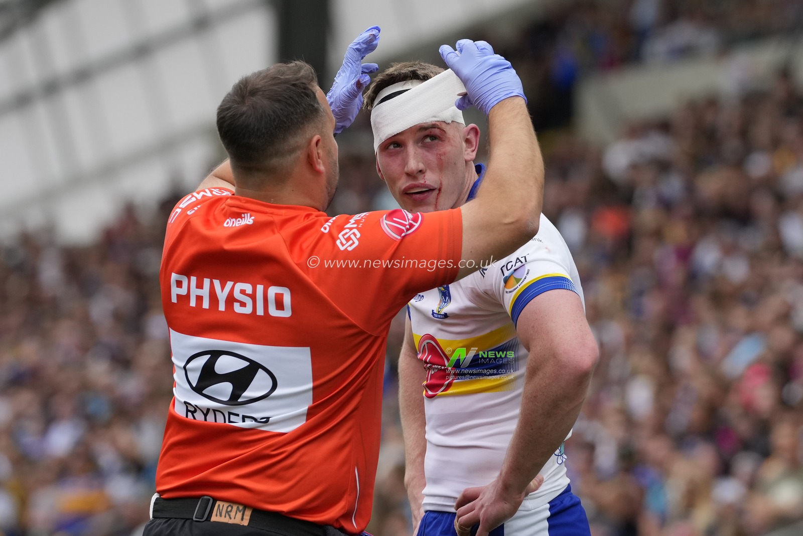 Matty Nicholson #12 of Warrington Wolves gets patched up after a head injury during the Betfred Super League Round 22 match Leeds Rhinos vs Warrington Wolves at Headingley Stadium, Leeds, United Kingdom, 20th August 2023

(Photo by Steve Flynn/News Images)