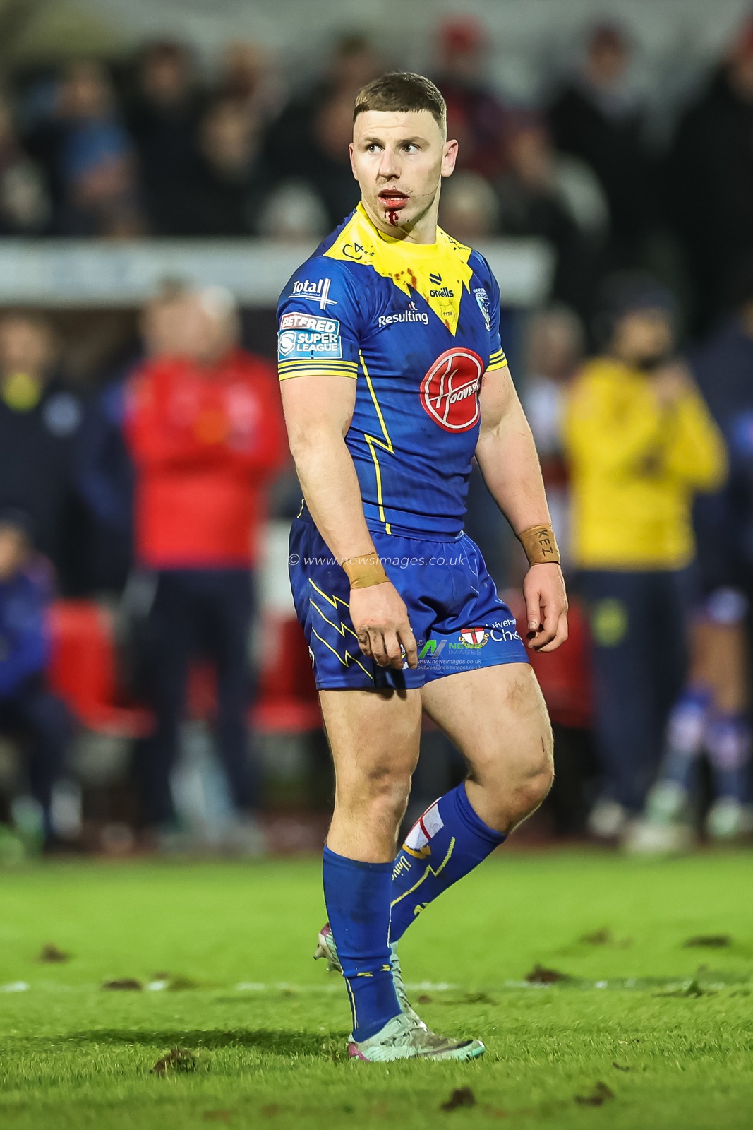 George Williams of Warrington Wolves with blood on his chin during the Betfred Super League Round 4 match Hull KR vs Warrington Wolves at Sewell Group Craven Park, Kingston upon Hull, United Kingdom, 7th March 2024

(Photo by Mark Cosgrove/News Images)