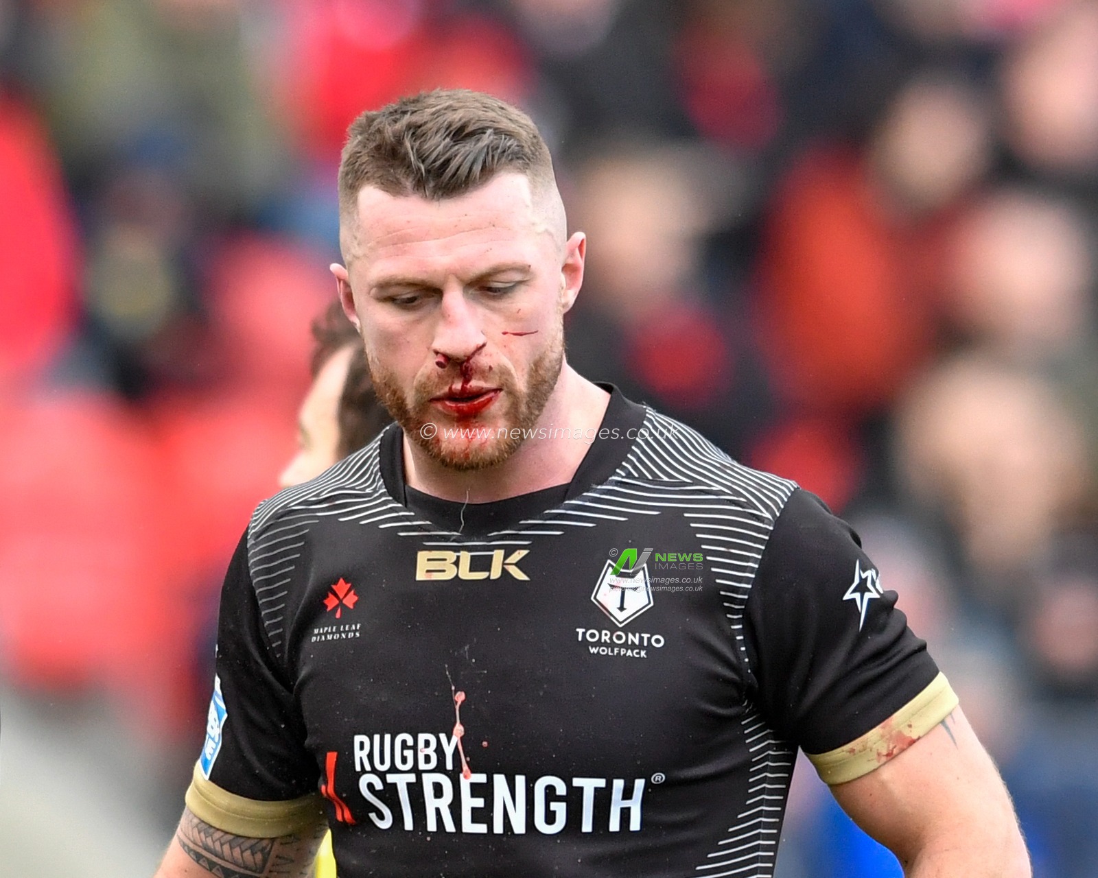 8th February 2020, AJ Bell Stadium, Eccles, England; Betfred Super League, Salford Red Devils v Toronto Wolfpack : Adam Sidlow (8) of Toronto Wolfpack has a bloody nose during the game