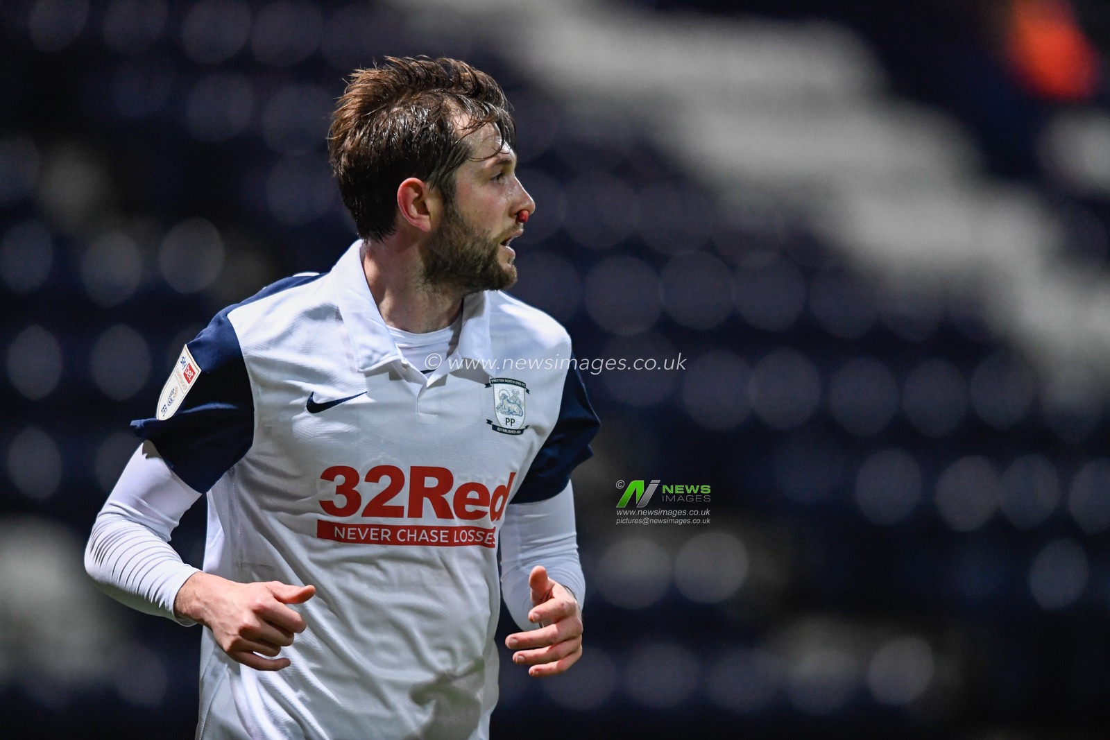 Tom Barkhuizen #29 of Preston North End with a bloody nose plug after receiving an injury on the pitch