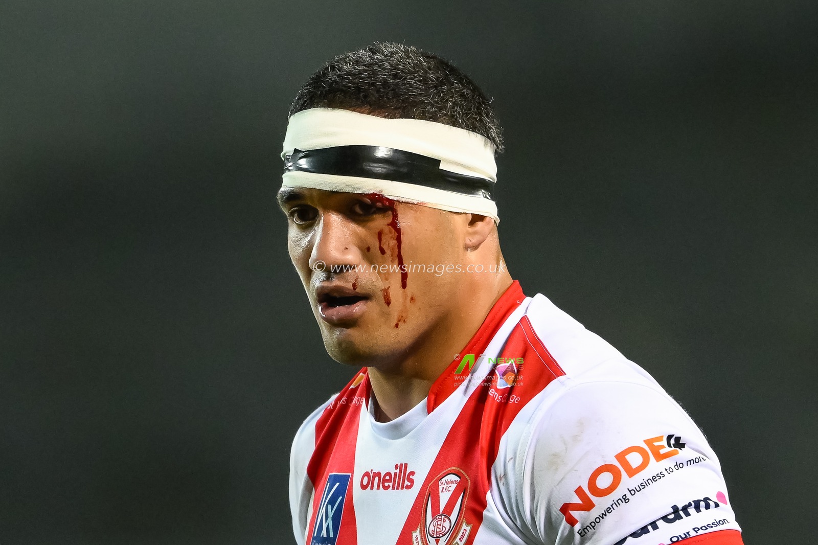 Sione Mataâ€™utia #11 of St. Helens bleeds from a cut to the head during the Betfred Super League Round 3 match St Helens vs Leeds Rhinos at Totally Wicked Stadium, St Helens, United Kingdom, 3rd March 2023

(Photo by Craig Thomas/News Images)